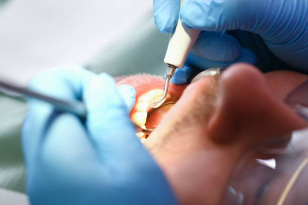 Best Emergency Dental Care for Sports Injuries in Kentland, IN
